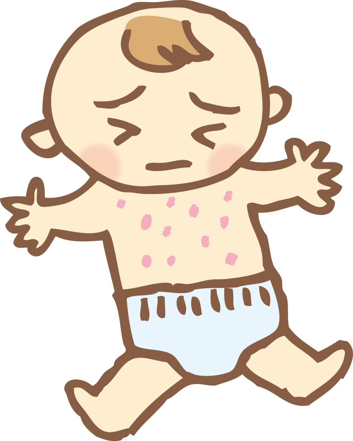 アトピー性皮膚炎